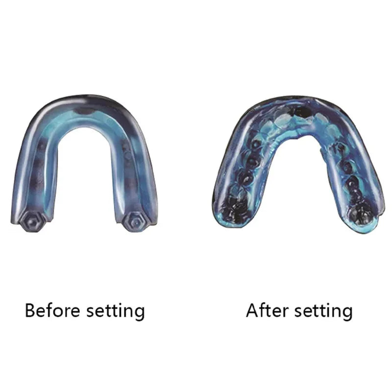 New oral protective gear, thermoplastic molded mouthguard, sports mouthguard, boxing mouthguard, adult mouthguard